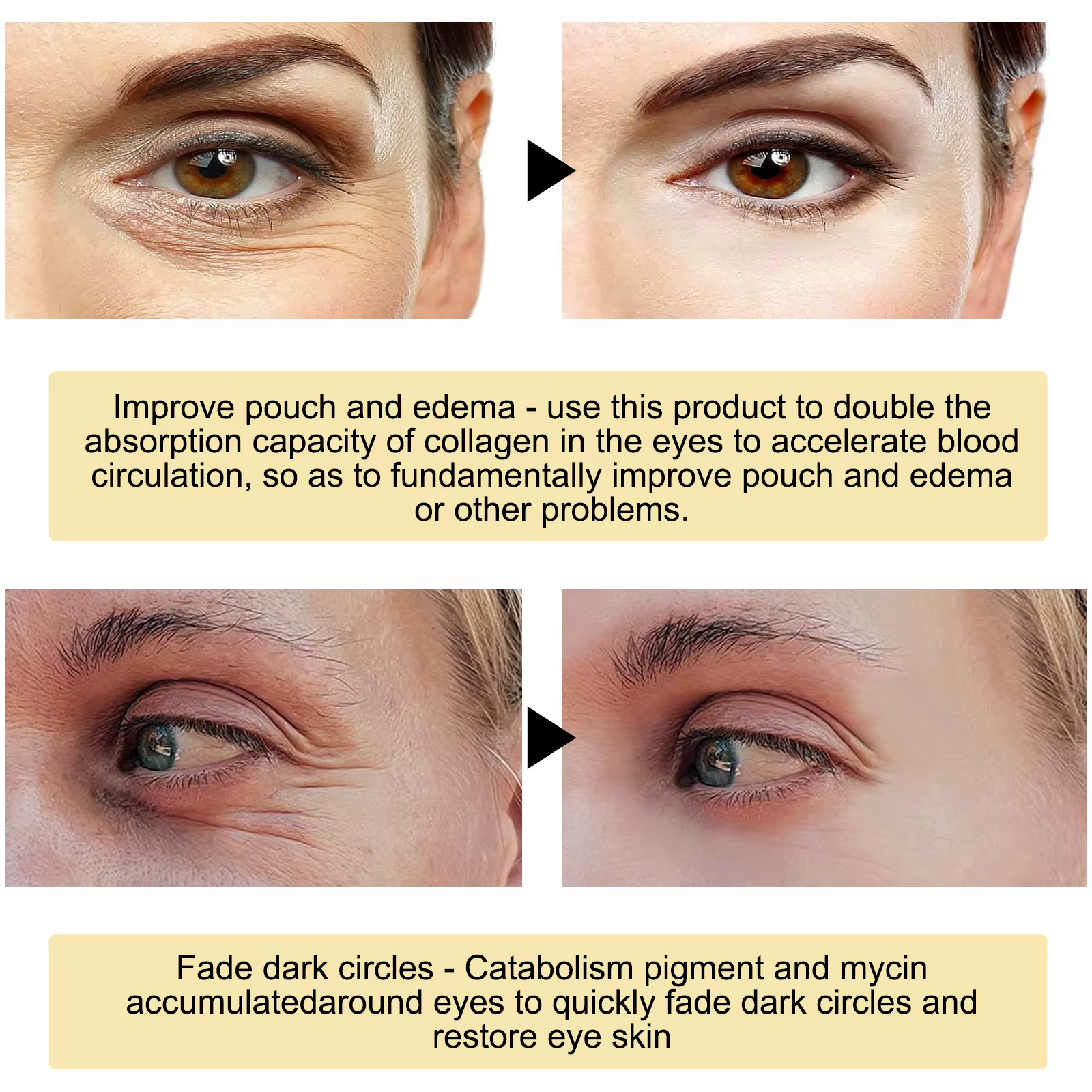 EELHOE 24K or masque pour les yeux Anti foncé hydratant sous les yeux coussinets de Gel revitalisant