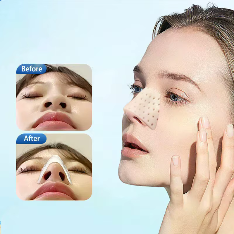Attelle nasale thermoplastique basse température pour rhinoplastie, immobilisation orthopédique des