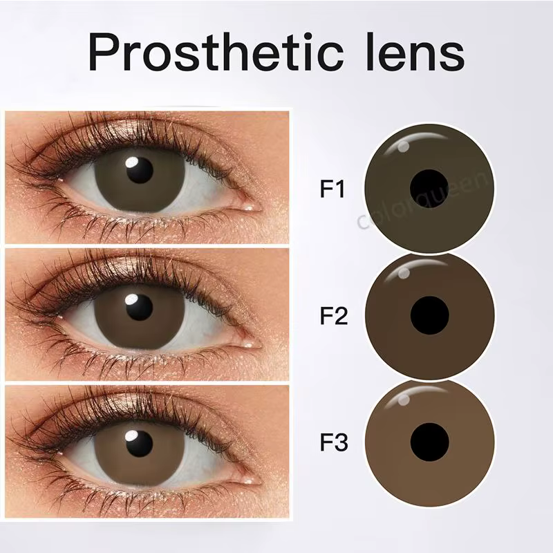 Lentilles de contact prothétiques pour les personnes souffrant de troubles oculaires