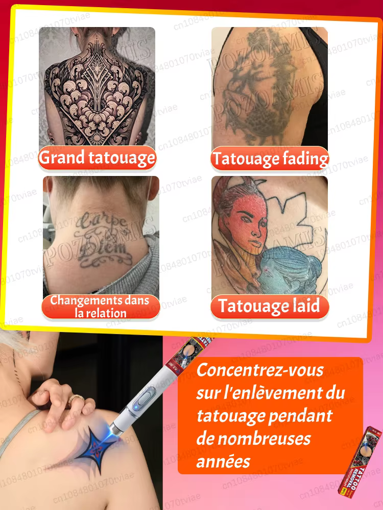 Thérapie par la lumière bleue pour les tatouages : élimination indolore des tatouages, kits à prix réduits disponibles.