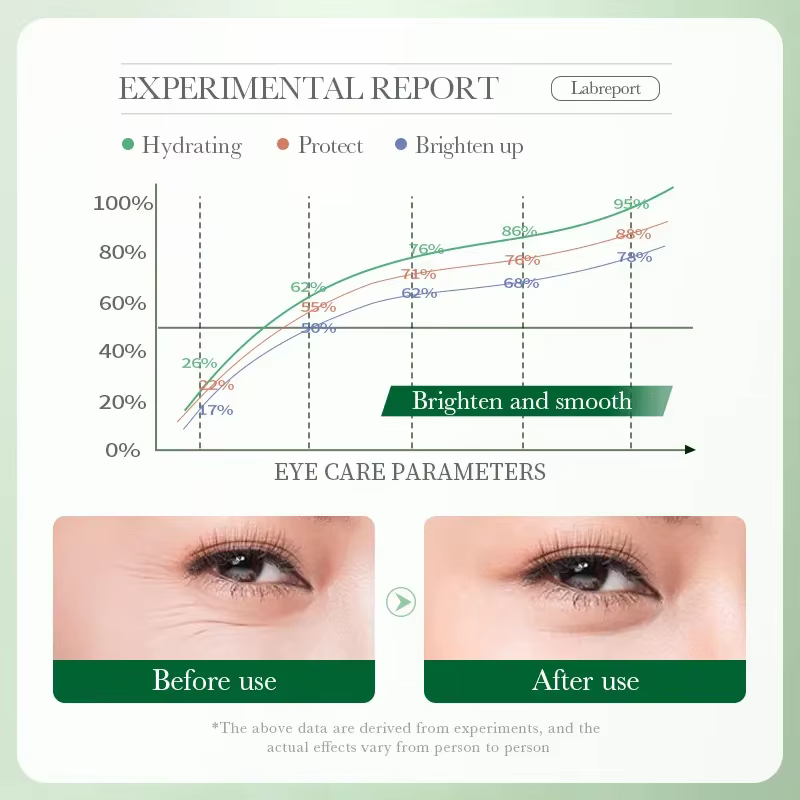 Crème pour les yeux, élimine les cernes, Anti-rides, estompe les ridules, élimine les poches pour les yeux, granulés de graisse, hydratante, éclaircissante, beauté et santé