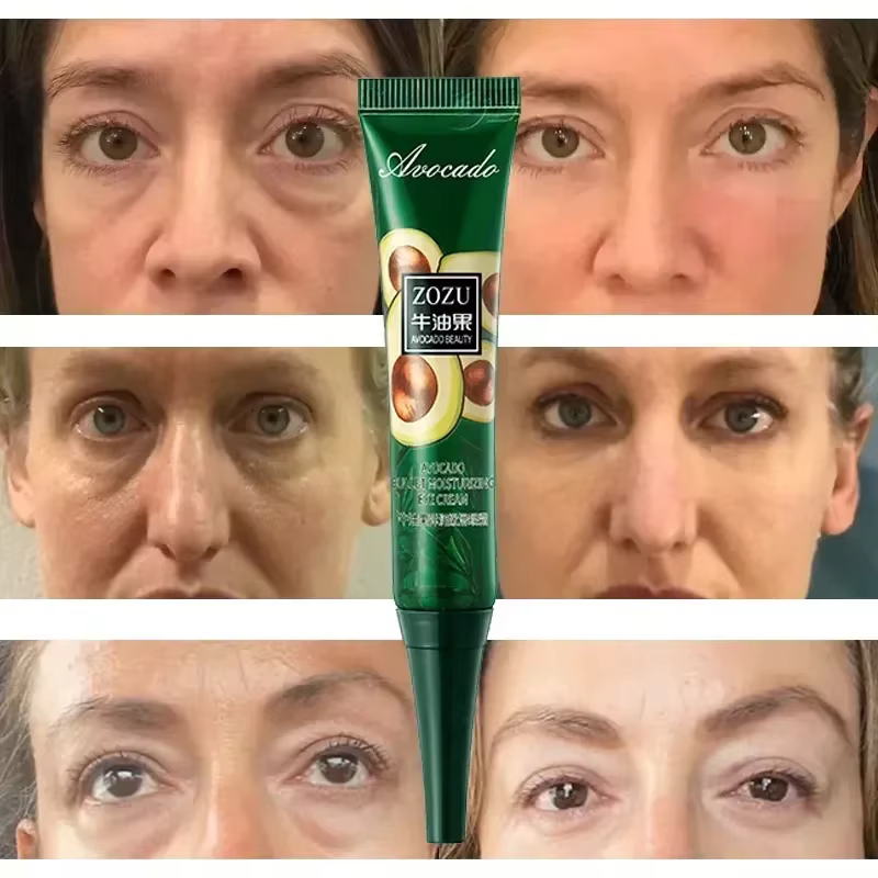 Crème pour les yeux, élimine les cernes