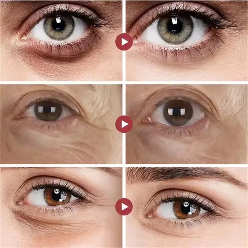 Les sacs pour les yeux crème élimine instantané les cernes resserre