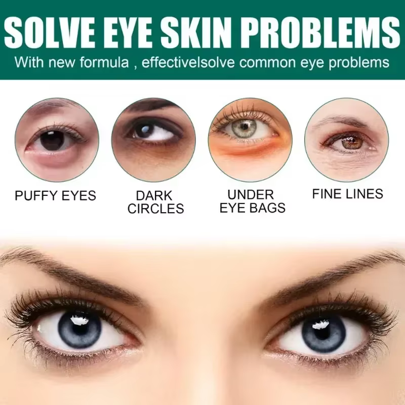 Crème pour les yeux, élimine les cernes