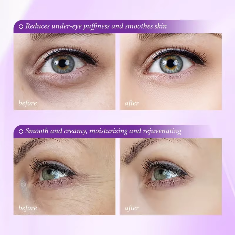 Crème instantanée pour l'élimination des poches oculaires