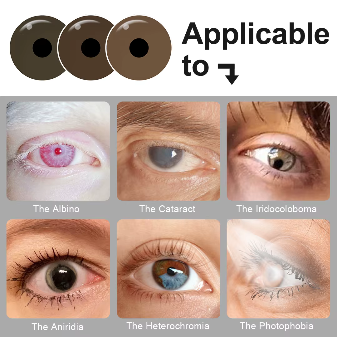 Lentilles de contact prothétiques Iris pour personnes souffrant de défauts oculaires