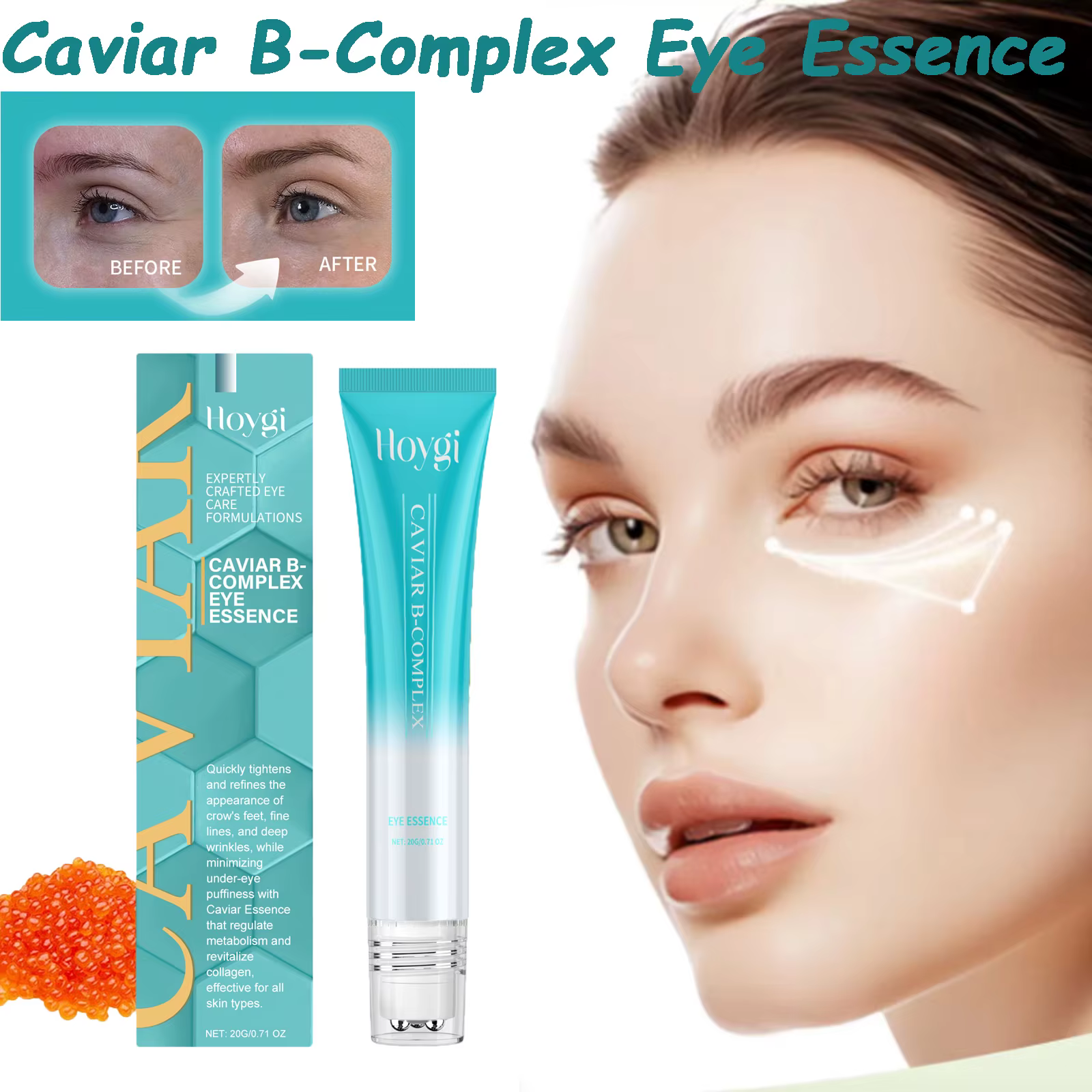 Caviar b-complexe Essence pour les yeux élimine les grappes foncées Anti-poches lissant les ridules hydrate la peau