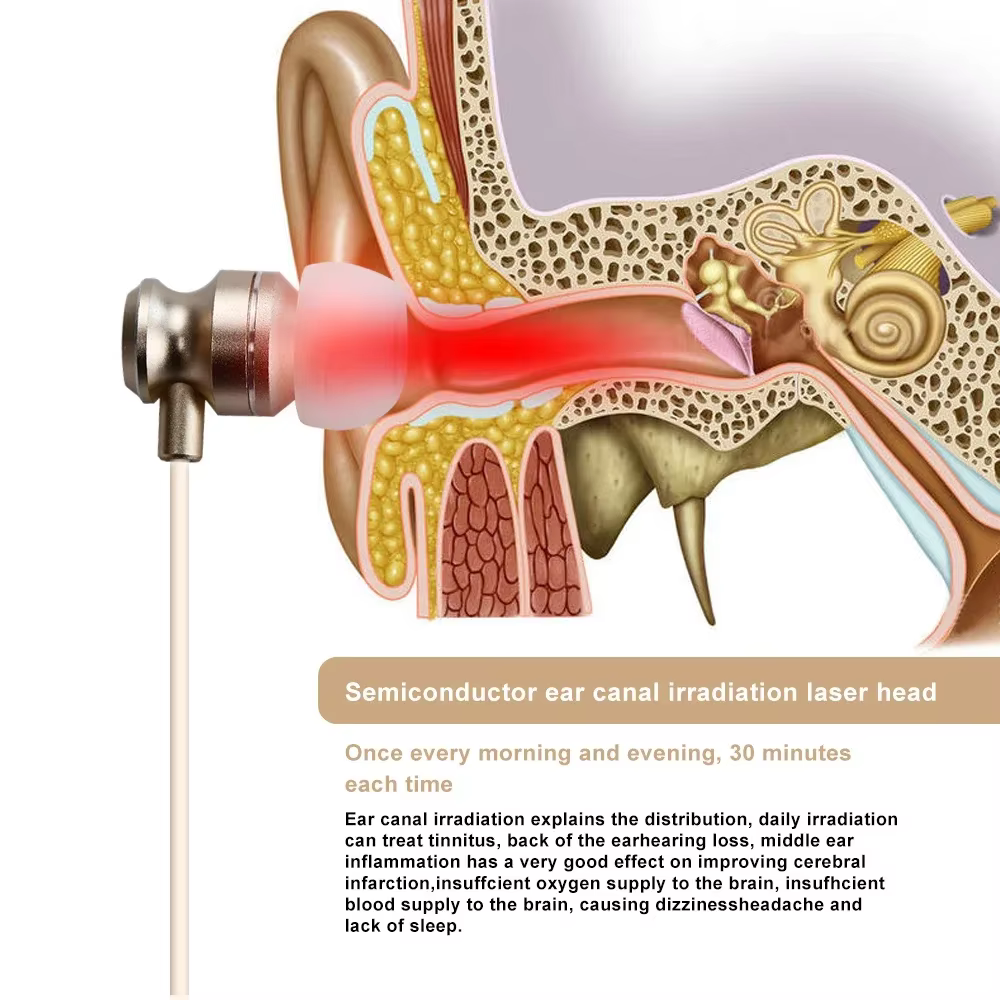 Appareil d'irradiation nasale LLLT portable à impulsions basse fréquence pour le soulagement de la rhinite, du nez qui coule et des éternuements à domicile